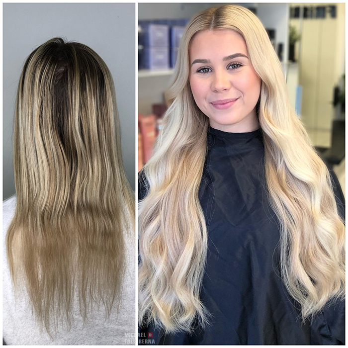 extensions